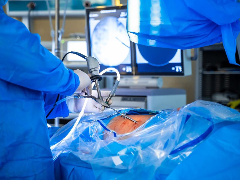 
													Advanced GI Laproscopy